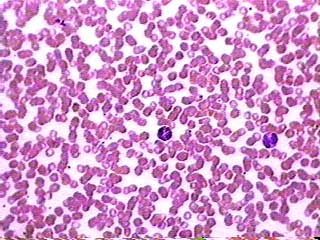 Hasil apusan darah tepi pada perbesaran 400x (sumber: Austin Community College. Blood smear, human [Internet]. www.austincc.edu. Available from: https://www.austincc.edu/histologyhelp/tissues/tt_blood.html)